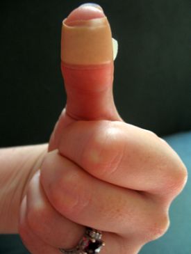 Not my thumb, but you get the point. 